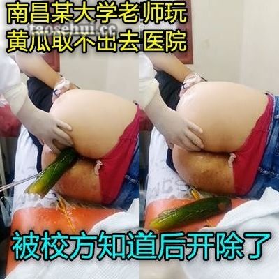 真实南昌一骚女往肛门塞黄瓜无法拔出被送到医院取出